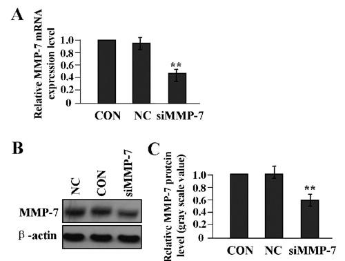 https://cdn.ncbi.nlm.nih.gov/pmc/blobs/aeb0/3980206/5ffc2f22d65c/ejh-2014-1-2262-g004.jpg