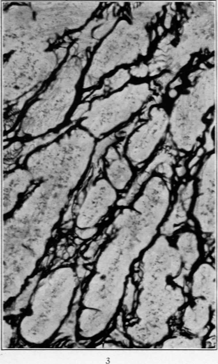 https://cdn.ncbi.nlm.nih.gov/pmc/blobs/aeb1/2007350/2a946f91cc38/amjpathol00614-0027-a.jpg