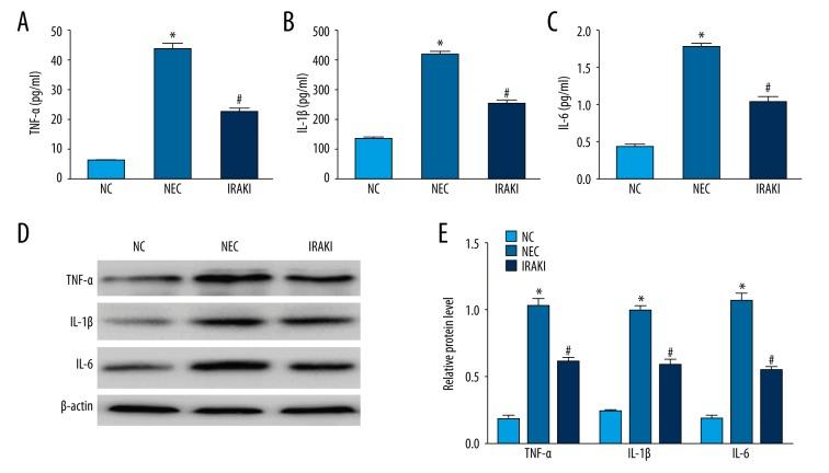 https://cdn.ncbi.nlm.nih.gov/pmc/blobs/aeb1/5992962/626a06e89f84/medscimonit-24-3366-g003.jpg