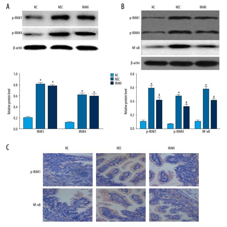 https://cdn.ncbi.nlm.nih.gov/pmc/blobs/aeb1/5992962/7cd580d5f116/medscimonit-24-3366-g004.jpg