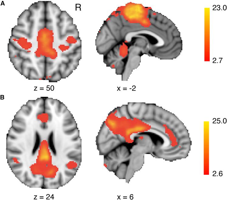 https://cdn.ncbi.nlm.nih.gov/pmc/blobs/aeb2/5640512/3d1fe407fe25/gr3.jpg