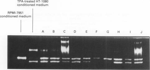 https://cdn.ncbi.nlm.nih.gov/pmc/blobs/aeb6/1968428/322eb3c57fea/brjcancer00207-0261-a.jpg