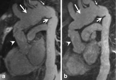 https://cdn.ncbi.nlm.nih.gov/pmc/blobs/aebc/2861759/a6ea37ba9a58/330_2009_1672_Fig4_HTML.jpg