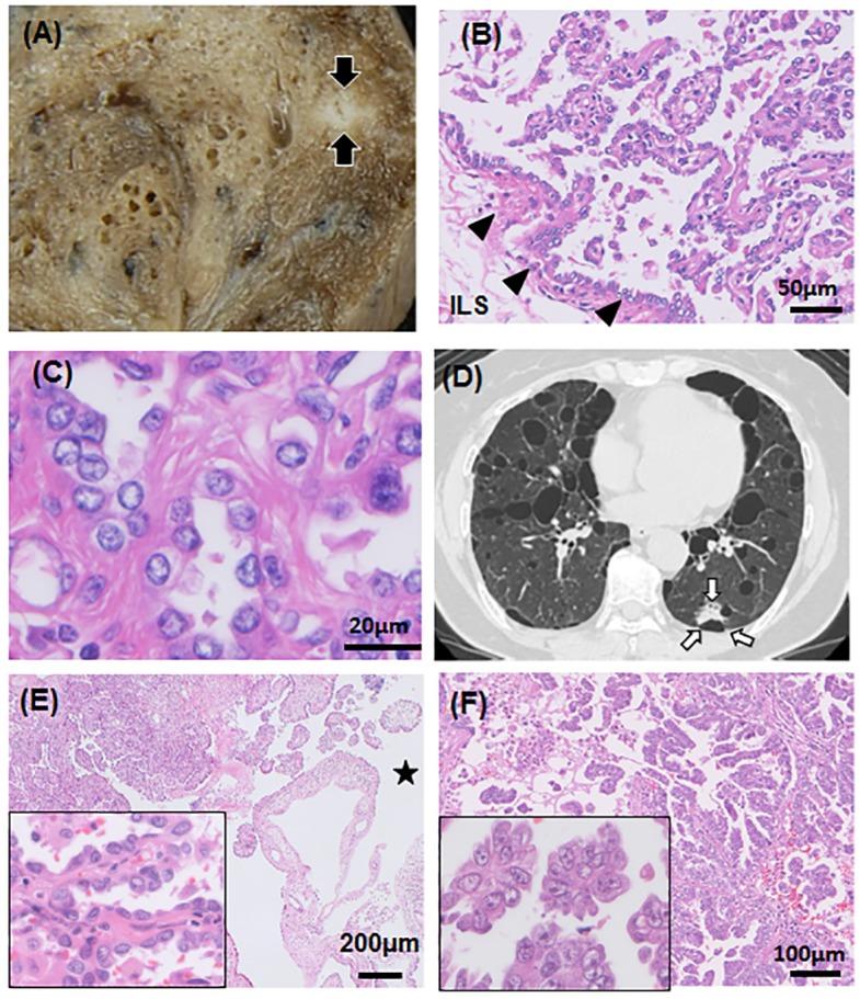 https://cdn.ncbi.nlm.nih.gov/pmc/blobs/aebf/4790923/441a45ee27e5/pone.0151476.g002.jpg