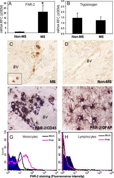 https://cdn.ncbi.nlm.nih.gov/pmc/blobs/aec1/2118197/ec9da4b43786/jem2030425f01.jpg