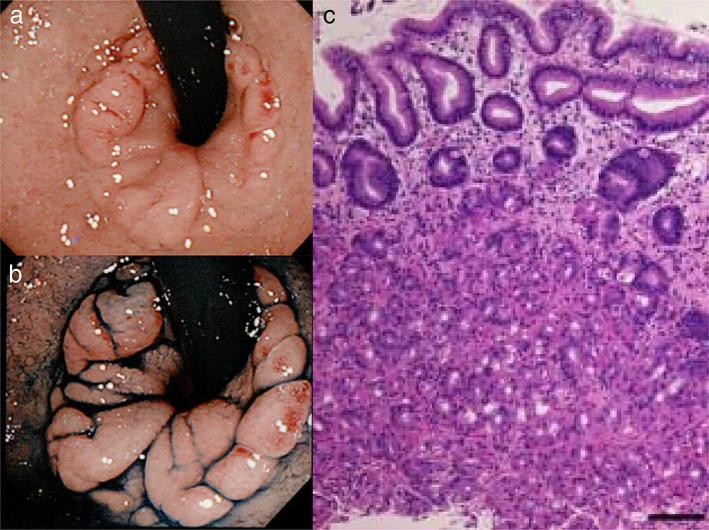 https://cdn.ncbi.nlm.nih.gov/pmc/blobs/aece/7857297/20c320406c8a/JGH3-5-312-g001.jpg