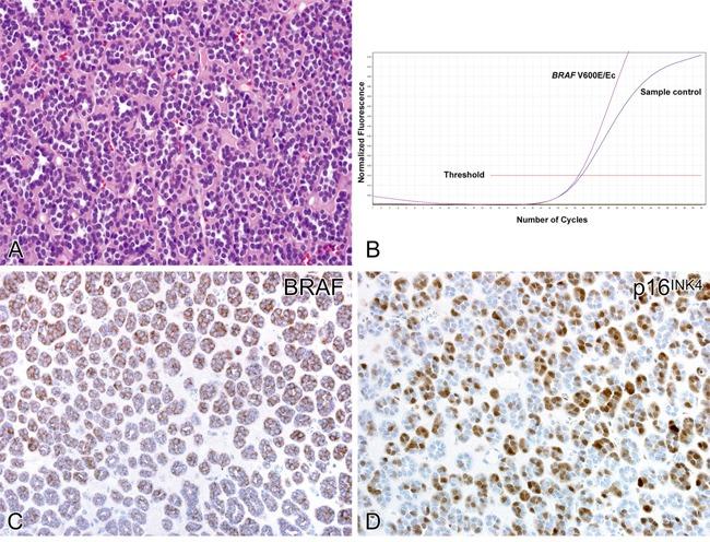 https://cdn.ncbi.nlm.nih.gov/pmc/blobs/aed5/5589565/8d29cafcff17/oncotarget-08-54096-g002.jpg