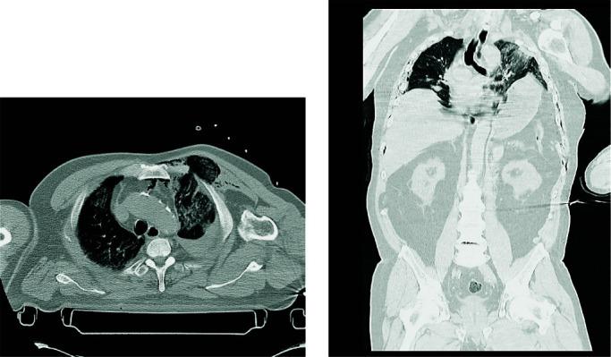 https://cdn.ncbi.nlm.nih.gov/pmc/blobs/aedf/9536169/1853b868aaff/acc-61-supl1-84-f1.jpg