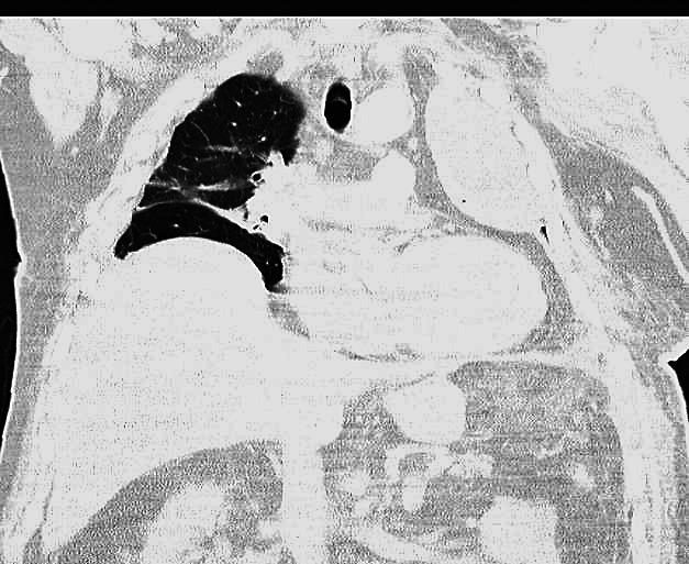 https://cdn.ncbi.nlm.nih.gov/pmc/blobs/aedf/9536169/dc3ad35d255e/acc-61-supl1-84-f3.jpg
