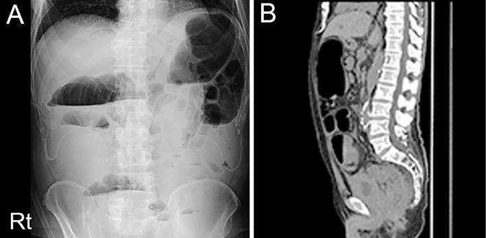 https://cdn.ncbi.nlm.nih.gov/pmc/blobs/aeee/8810238/2df35175a7d2/1349-7235-61-0097-g002.jpg