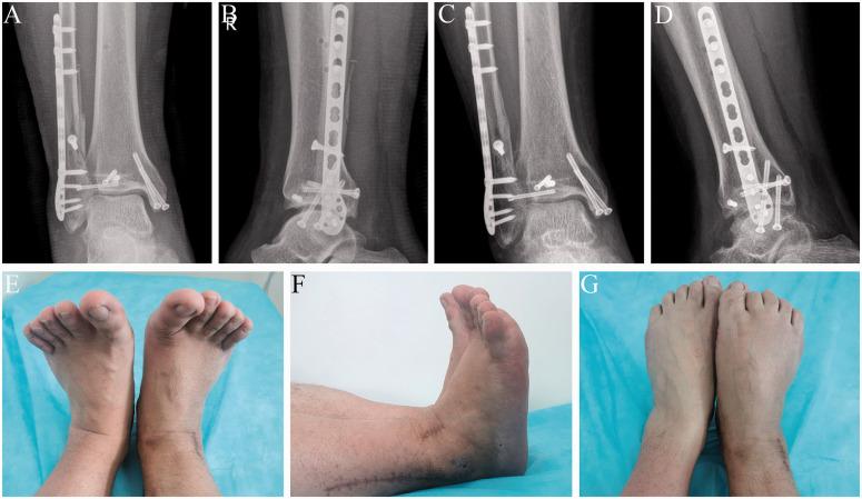 https://cdn.ncbi.nlm.nih.gov/pmc/blobs/aef5/9561648/3469191760d5/10.1177_03000605221090849-fig3.jpg