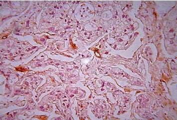 https://cdn.ncbi.nlm.nih.gov/pmc/blobs/aef6/7542532/7267dcfca540/JIR2020-6148286.008.jpg