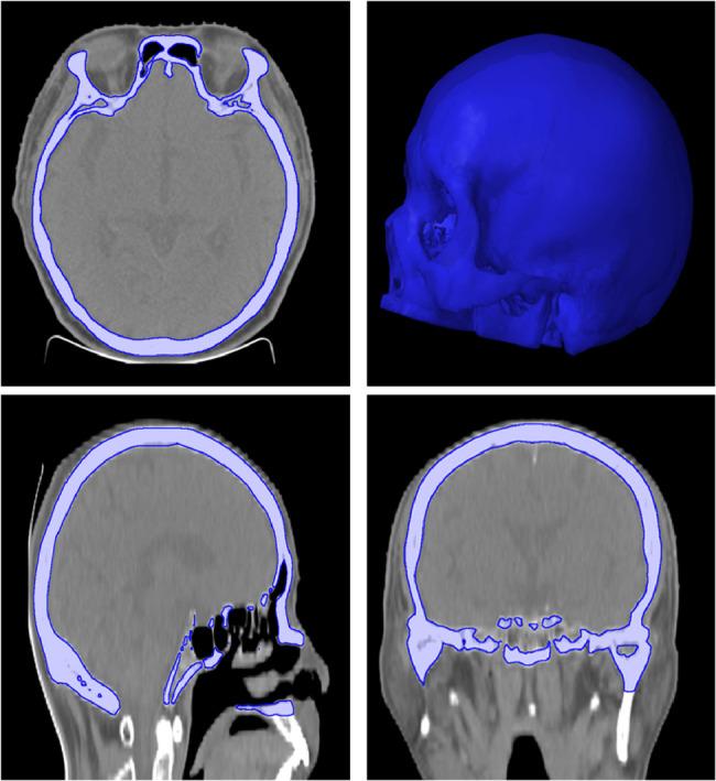 https://cdn.ncbi.nlm.nih.gov/pmc/blobs/aef8/12211941/f37e577c4fd7/12885_2025_14495_Fig1_HTML.jpg