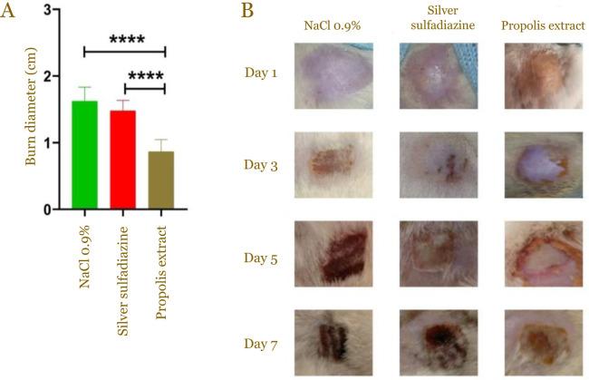 https://cdn.ncbi.nlm.nih.gov/pmc/blobs/aefe/12059813/f3a9ddd8aa7e/NarraJ-5-e2359-g001.jpg
