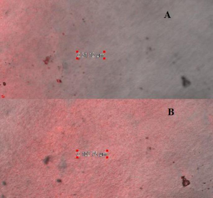https://cdn.ncbi.nlm.nih.gov/pmc/blobs/af03/7462482/abe14d03b6f3/ijpr-19-292-g009.jpg