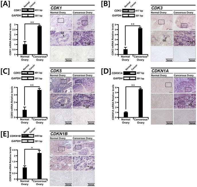https://cdn.ncbi.nlm.nih.gov/pmc/blobs/af09/3517539/38480abdcb4e/pone.0051592.g002.jpg