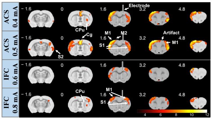 https://cdn.ncbi.nlm.nih.gov/pmc/blobs/af0a/10526916/2c6cbc5fbd7a/brainsci-13-01317-g002.jpg
