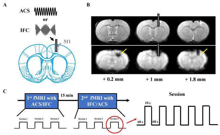 https://cdn.ncbi.nlm.nih.gov/pmc/blobs/af0a/10526916/e6cca9e67562/brainsci-13-01317-g001.jpg