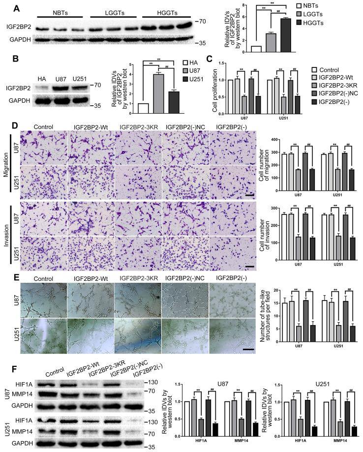 https://cdn.ncbi.nlm.nih.gov/pmc/blobs/af0b/8326132/e3628e663f27/ijbsv17p2912g003.jpg