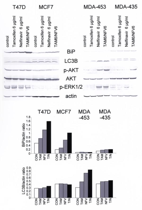 https://cdn.ncbi.nlm.nih.gov/pmc/blobs/af10/2949632/b908003b794b/bcr2602-5.jpg