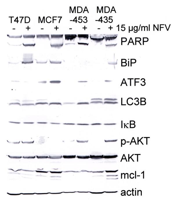https://cdn.ncbi.nlm.nih.gov/pmc/blobs/af10/2949632/ccc2859095d0/bcr2602-4.jpg