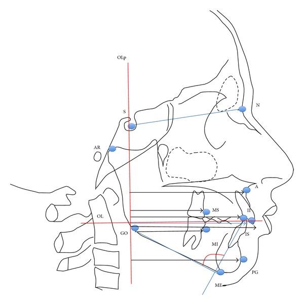 https://cdn.ncbi.nlm.nih.gov/pmc/blobs/af11/4055152/eb478f1d731d/IJD2014-173187.002.jpg