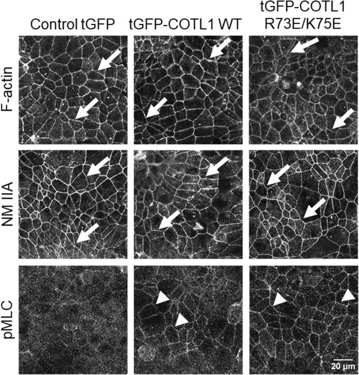 https://cdn.ncbi.nlm.nih.gov/pmc/blobs/af16/11260685/435f12f4ce32/fcell-12-1405454-g009.jpg