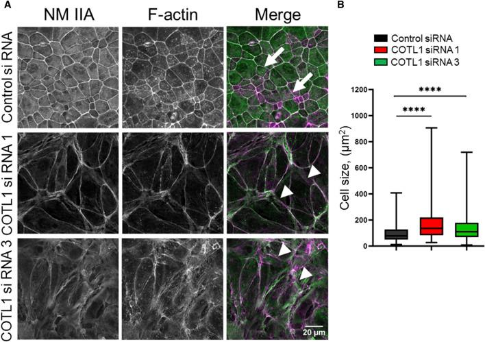 https://cdn.ncbi.nlm.nih.gov/pmc/blobs/af16/11260685/4b215d974c5d/fcell-12-1405454-g005.jpg