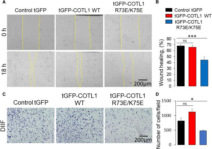 https://cdn.ncbi.nlm.nih.gov/pmc/blobs/af16/11260685/cd8fc335370a/fcell-12-1405454-g010.jpg