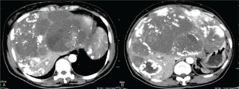 https://cdn.ncbi.nlm.nih.gov/pmc/blobs/af17/6641855/06a1fca77c51/medi-98-e16245-g005.jpg