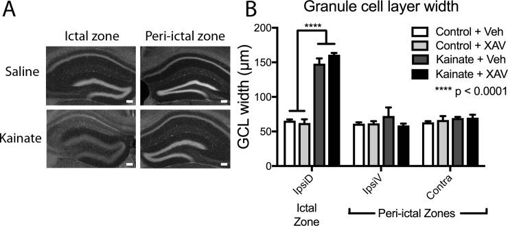 https://cdn.ncbi.nlm.nih.gov/pmc/blobs/af18/6785072/1174ddbe4ec1/pone.0215789.g003.jpg