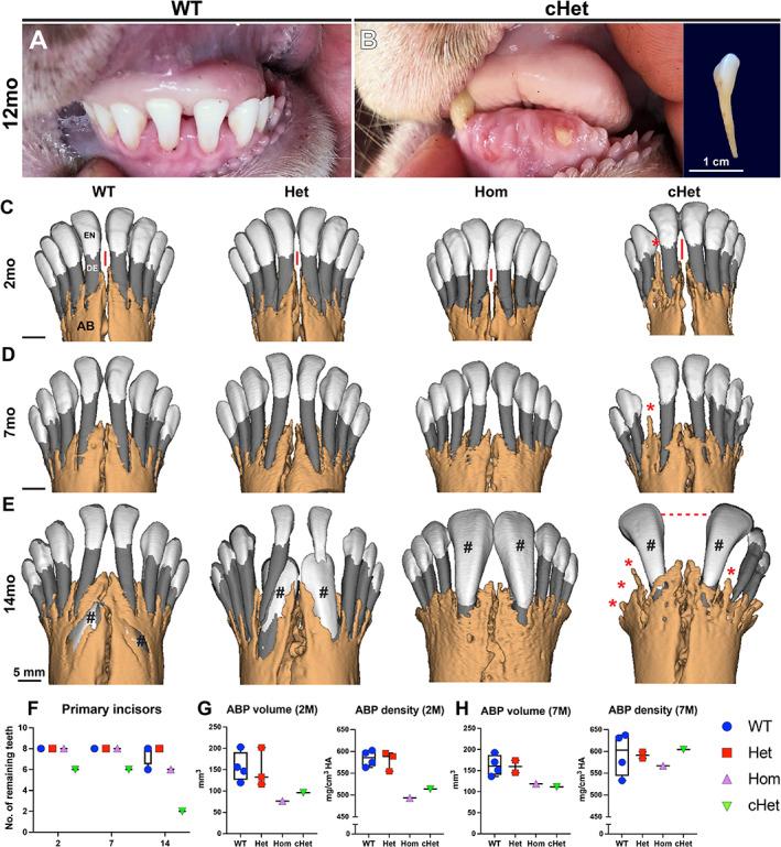 https://cdn.ncbi.nlm.nih.gov/pmc/blobs/af20/9804700/742ed9131e91/JBMR-37-2005-g004.jpg