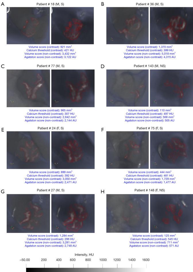https://cdn.ncbi.nlm.nih.gov/pmc/blobs/af21/10784098/2188bb90c270/qims-14-01-1-f3.jpg