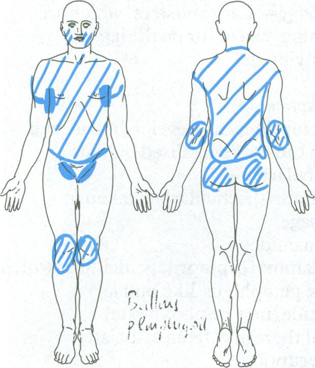 https://cdn.ncbi.nlm.nih.gov/pmc/blobs/af27/1248550/6cc9dd47c818/bmjcred00048-0041-a.jpg