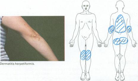 https://cdn.ncbi.nlm.nih.gov/pmc/blobs/af27/1248550/a20d6874eb80/bmjcred00048-0040-a.jpg