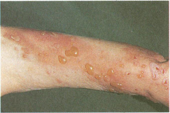 https://cdn.ncbi.nlm.nih.gov/pmc/blobs/af27/1248550/b0d53bf81e36/bmjcred00048-0040-d.jpg