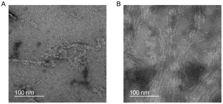 https://cdn.ncbi.nlm.nih.gov/pmc/blobs/af28/10671303/2ed3cef4ea8c/ijms-24-16395-g007.jpg