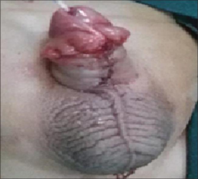 https://cdn.ncbi.nlm.nih.gov/pmc/blobs/af29/8423161/8decd9c563fb/AJPS-18-201-g005.jpg