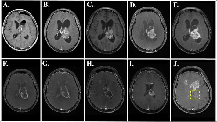 https://cdn.ncbi.nlm.nih.gov/pmc/blobs/af2b/12367499/d181b7634507/fonc-15-1606575-g003.jpg