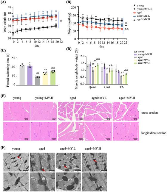https://cdn.ncbi.nlm.nih.gov/pmc/blobs/af2c/11167181/1a2a8bd7d088/MCO2-5-e566-g004.jpg