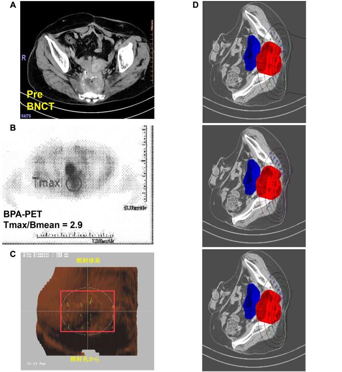 https://cdn.ncbi.nlm.nih.gov/pmc/blobs/af2e/12041971/566dd3c3e4c4/in_vivo-39-1481-g0001.jpg