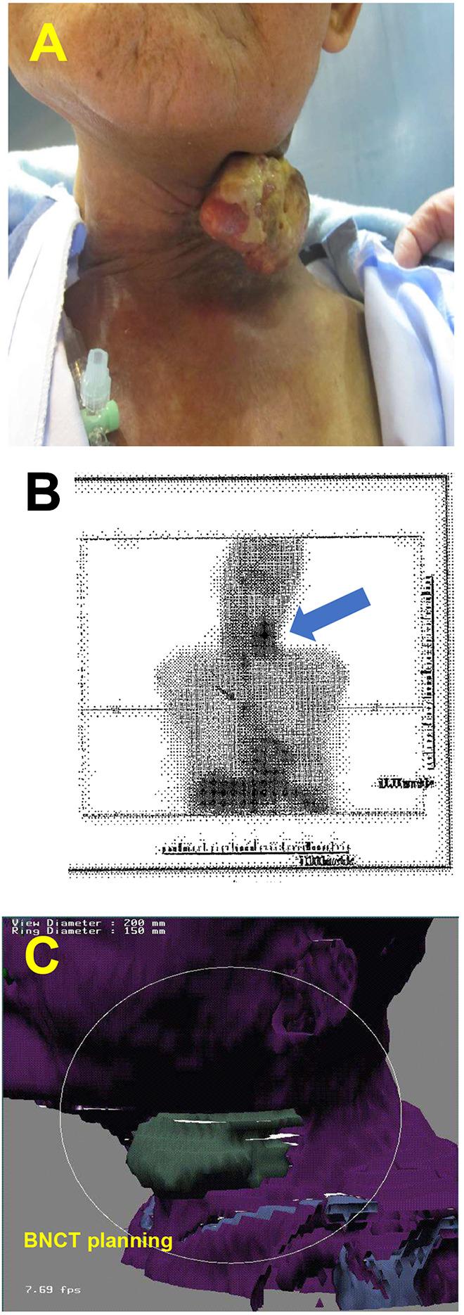 https://cdn.ncbi.nlm.nih.gov/pmc/blobs/af2e/12041971/65eb8ee24229/in_vivo-39-1473-g0001.jpg