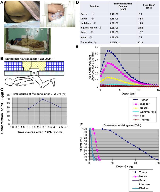 https://cdn.ncbi.nlm.nih.gov/pmc/blobs/af2e/12041971/68d351a23637/in_vivo-39-1479-g0001.jpg