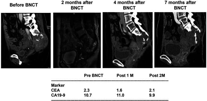 https://cdn.ncbi.nlm.nih.gov/pmc/blobs/af2e/12041971/7192258848f5/in_vivo-39-1480-g0001.jpg