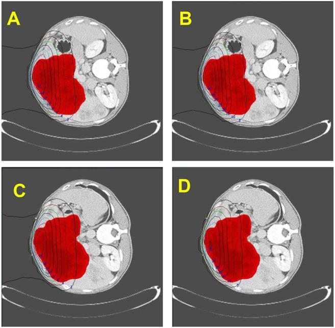 https://cdn.ncbi.nlm.nih.gov/pmc/blobs/af2e/12041971/f0dea1fc1ccc/in_vivo-39-1486-g0001.jpg