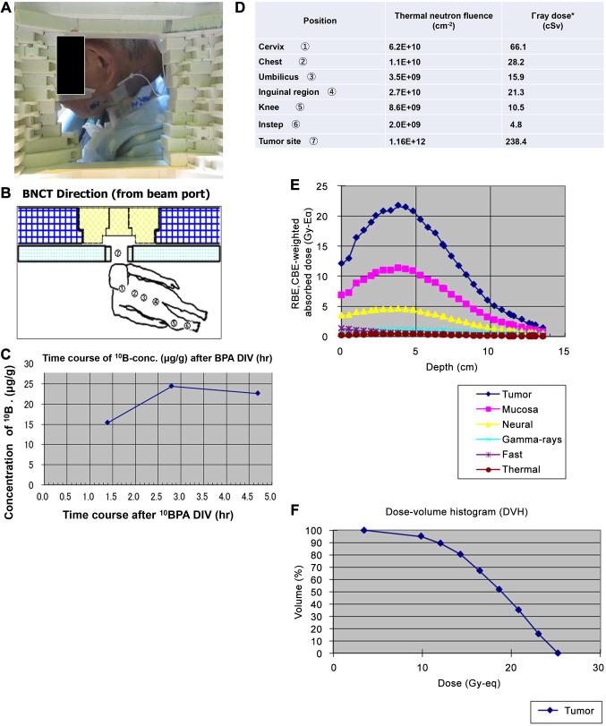 https://cdn.ncbi.nlm.nih.gov/pmc/blobs/af2e/12041971/ff29364fe98e/in_vivo-39-1476-g0001.jpg