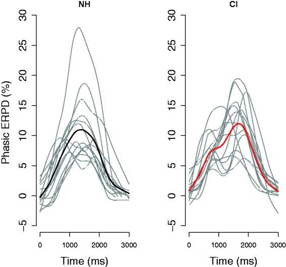 https://cdn.ncbi.nlm.nih.gov/pmc/blobs/af31/6537294/f9c281f56b36/10.1177_2331216519845596-fig3.jpg