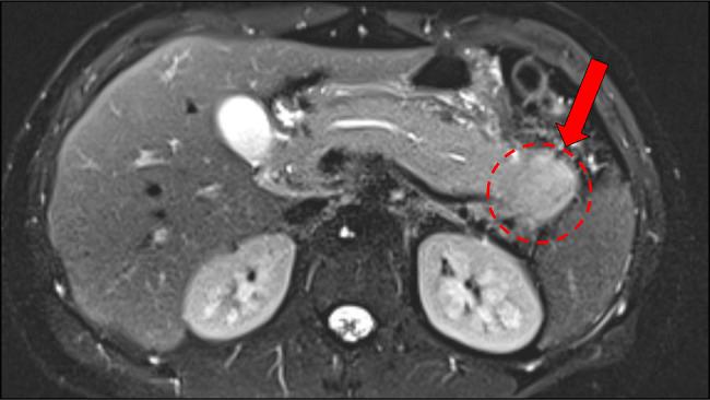 https://cdn.ncbi.nlm.nih.gov/pmc/blobs/af34/10977588/f08e51798c7a/ac9-11-e01320-g001.jpg