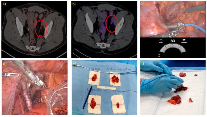https://cdn.ncbi.nlm.nih.gov/pmc/blobs/af35/11720234/799e25828794/cancers-17-00093-g001.jpg
