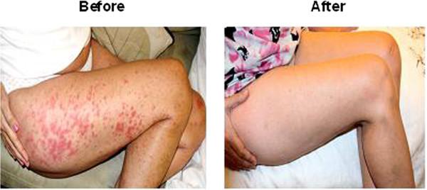 https://cdn.ncbi.nlm.nih.gov/pmc/blobs/af37/4409606/a37adaa668aa/40064_2014_1511_Fig2_HTML.jpg